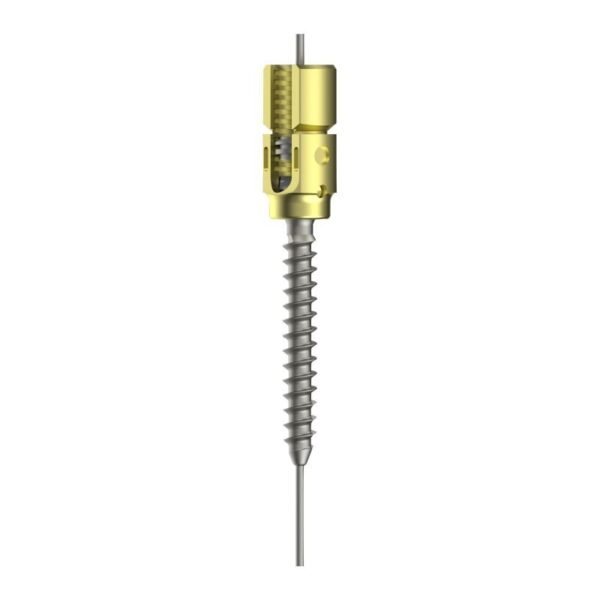 Polyaxial R-Line Cannulated Reduction Screw