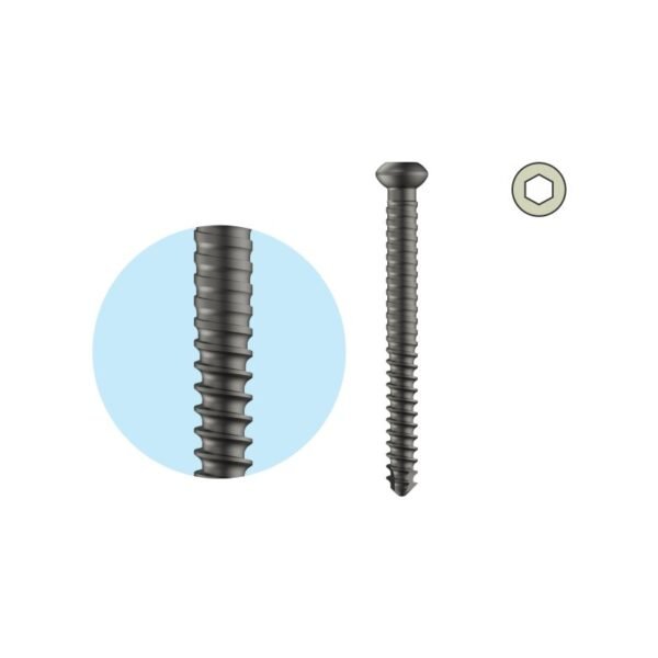 Dual Core Locking Bolt Dia. 4.7mm - Self Tapping