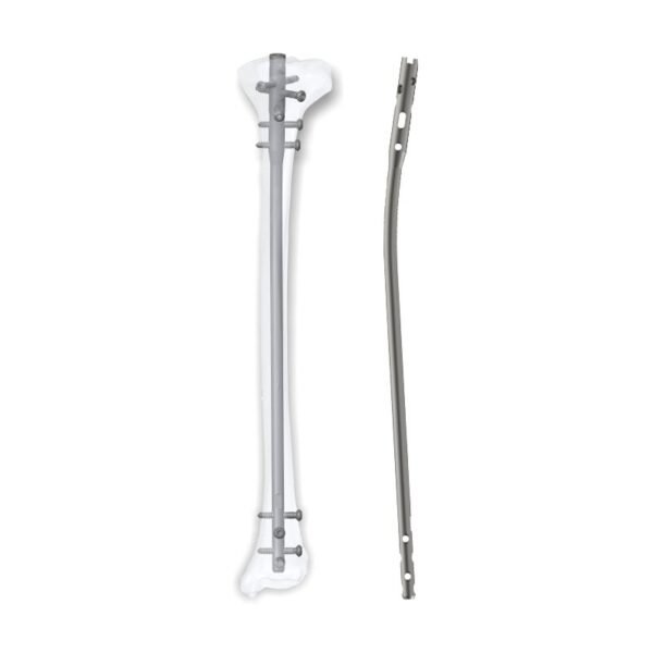 Aduera™ Expert Tibia Nail - Titanium