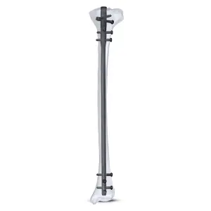 Aduera Expert Tibia & Femur Nailing System