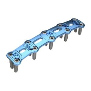 CERVELOCK<sup>TM</sup> Anterior Cervical Plate Four-Level – Titanium