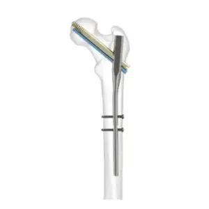 Durofix Intertan Nailing System
